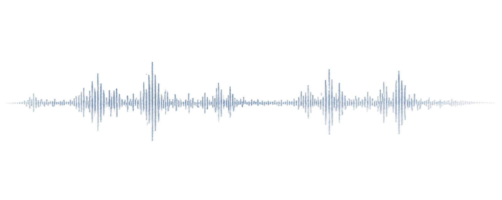Pencil-sketch waveform — what most systems capture